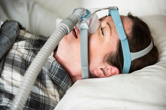 Sleep apnea obstructive treatment apnoea diabetes blood sugar cause between