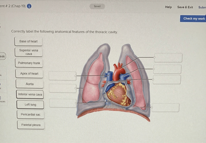 Cavity thoracic